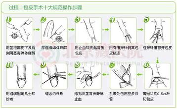 怎么才能更好的治疗包茎